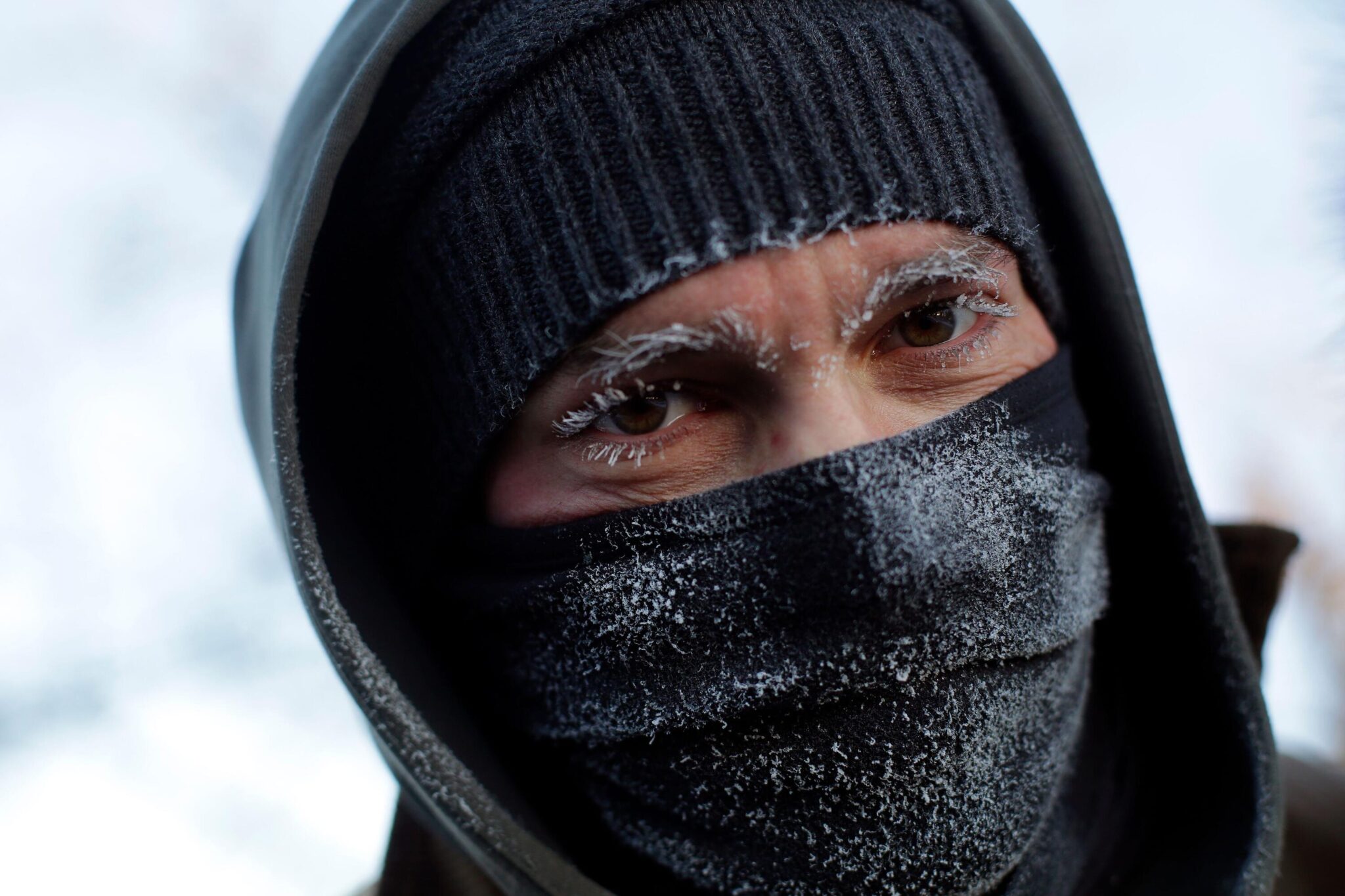 Medical Effects Of Extreme Cold: Why It Hurts And How To Stay Safe ...