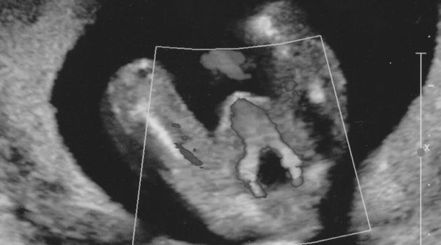 ultrasound image