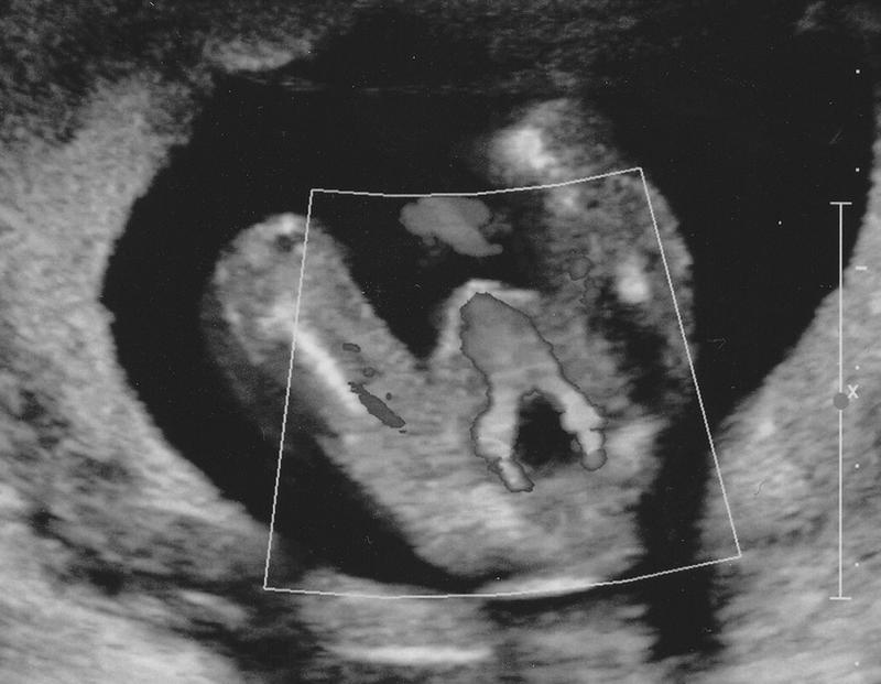 ultrasound image